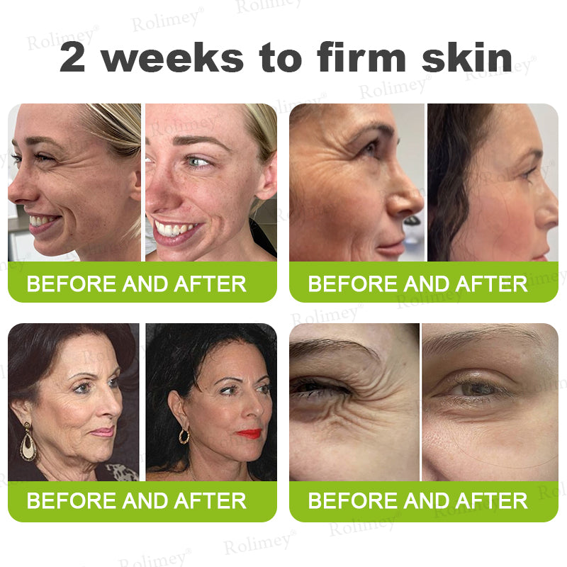 🍃Natravor®Wrinkle-Lift Tightening stick