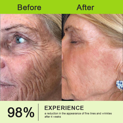 🍃Natravor®Wrinkle-Lift Tightening stick